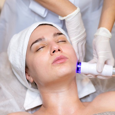 Laser Treatments
