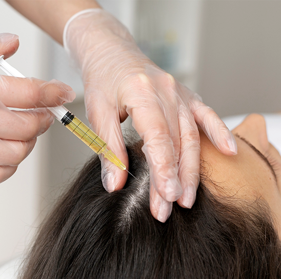 Hair PRP Therapy & GFC Treatment