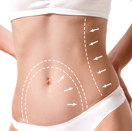 Body Contouring