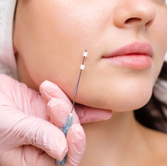 ThreadLift Treatment